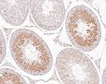 Aurora A Antibody in Immunohistochemistry (Paraffin) (IHC (P))