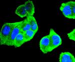 Aurora A Antibody in Immunocytochemistry (ICC/IF)