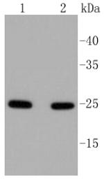 RAB5 Antibody in Western Blot (WB)