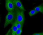 PIK3R2 Antibody in Immunocytochemistry (ICC/IF)