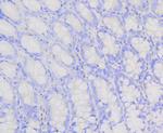 PIK3R2 Antibody in Immunohistochemistry (Paraffin) (IHC (P))