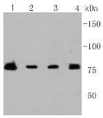 PIK3R2 Antibody in Western Blot (WB)