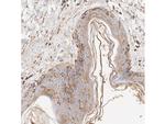 Vitronectin Antibody in Immunohistochemistry (Paraffin) (IHC (P))