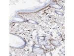 Vitronectin Antibody in Immunohistochemistry (Paraffin) (IHC (P))