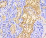 Vitronectin Antibody in Immunohistochemistry (Paraffin) (IHC (P))