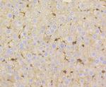 Vitronectin Antibody in Immunohistochemistry (Paraffin) (IHC (P))