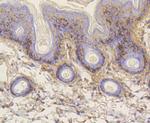 Vitronectin Antibody in Immunohistochemistry (Paraffin) (IHC (P))