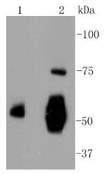 Vitronectin Antibody in Western Blot (WB)