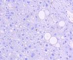 Phospho-JNK1/JNK2/JNK3 (Thr183, Thr221) Antibody in Immunohistochemistry (Paraffin) (IHC (P))