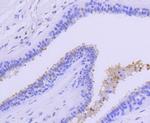 PRMT5 Antibody in Immunohistochemistry (Paraffin) (IHC (P))