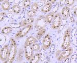 PRMT5 Antibody in Immunohistochemistry (Paraffin) (IHC (P))