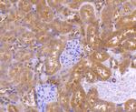 PRMT5 Antibody in Immunohistochemistry (Paraffin) (IHC (P))