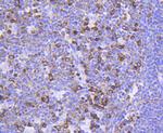 Phospho-FOXO3A (Ser253) Antibody in Immunohistochemistry (Paraffin) (IHC (P))