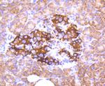 Phospho-FOXO3A (Ser253) Antibody in Immunohistochemistry (Paraffin) (IHC (P))