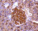 Phospho-FOXO3A (Ser253) Antibody in Immunohistochemistry (Paraffin) (IHC (P))