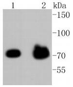 Phospho-FOXO3A (Ser253) Antibody in Western Blot (WB)