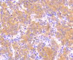 Phospho-MEK1 (Ser218, Ser222) Antibody in Immunohistochemistry (Paraffin) (IHC (P))