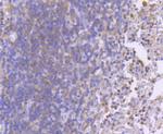 Phospho-MEK1 (Ser218, Ser222) Antibody in Immunohistochemistry (Paraffin) (IHC (P))