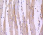 ROCK1 Antibody in Immunohistochemistry (Paraffin) (IHC (P))