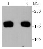 ROCK1 Antibody in Western Blot (WB)