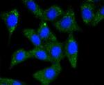 Synuclein alpha/beta Antibody in Immunocytochemistry (ICC/IF)