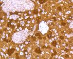 Synuclein alpha/beta Antibody in Immunohistochemistry (Paraffin) (IHC (P))