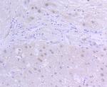 HIF-1 beta Antibody in Immunohistochemistry (Paraffin) (IHC (P))