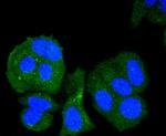 Chk1 Antibody in Immunocytochemistry (ICC/IF)