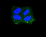 Cytokeratin 10 Antibody in Immunocytochemistry (ICC/IF)