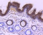 Cytokeratin 10 Antibody in Immunohistochemistry (Paraffin) (IHC (P))