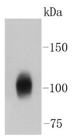 Sodium Potassium ATPase Antibody in Western Blot (WB)