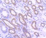 Acetyl-CoA Carboxylase Antibody in Immunohistochemistry (Paraffin) (IHC (P))