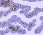 Acetyl-CoA Carboxylase Antibody in Immunohistochemistry (Paraffin) (IHC (P))