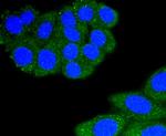 CD11a (LFA-1alpha) Antibody in Immunocytochemistry (ICC/IF)