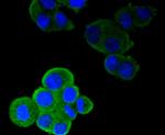 CD11a (LFA-1alpha) Antibody in Immunocytochemistry (ICC/IF)