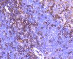 CD11a (LFA-1alpha) Antibody in Immunohistochemistry (Paraffin) (IHC (P))