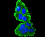 Cytokeratin 16 Antibody in Immunocytochemistry (ICC/IF)