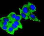 Cytokeratin 16 Antibody in Immunocytochemistry (ICC/IF)