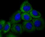 Cytokeratin 16 Antibody in Immunocytochemistry (ICC/IF)