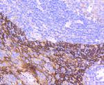 Cytokeratin 16 Antibody in Immunohistochemistry (Paraffin) (IHC (P))