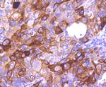 Cytokeratin 16 Antibody in Immunohistochemistry (Paraffin) (IHC (P))