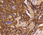 Cytokeratin 16 Antibody in Immunohistochemistry (Paraffin) (IHC (P))