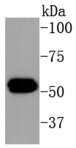 Cytokeratin 16 Antibody in Western Blot (WB)