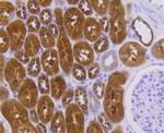 PEBP1 Antibody in Immunohistochemistry (Paraffin) (IHC (P))