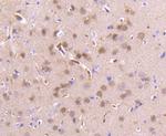 PEBP1 Antibody in Immunohistochemistry (Paraffin) (IHC (P))