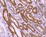 BCL2A1 Antibody in Immunohistochemistry (Paraffin) (IHC (P))