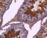 Phospho-PRKAR2A (Ser99) Antibody in Immunohistochemistry (Paraffin) (IHC (P))