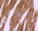 Phospho-PRKAR2A (Ser99) Antibody in Immunohistochemistry (Paraffin) (IHC (P))