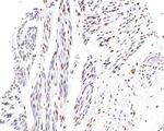 Phospho-ATF2 (Thr71) Antibody in Immunohistochemistry (Paraffin) (IHC (P))