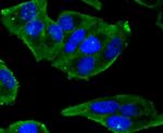 Phospho-Estrogen Receptor alpha (Ser118) Antibody in Immunocytochemistry (ICC/IF)